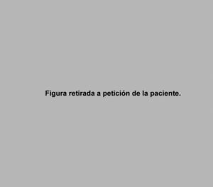 Figura 8