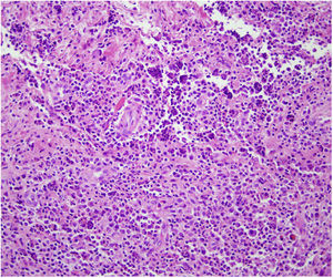 Hematoxylin–eosin, ×20.