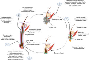 Alopecia and chemotherapy. Main sites where chemotherapy affects the hair cycle and generates alopecia (image created with BioRender).