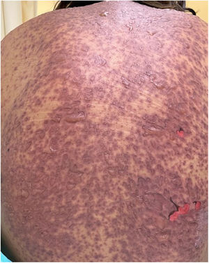 Case 3: Condition after 48h.