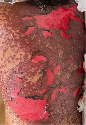 Case 3: Condition after 72h.