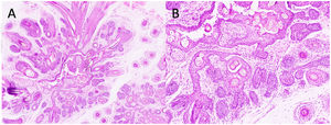 Hematoxilina-eosina: A) ×10, B) ×20.