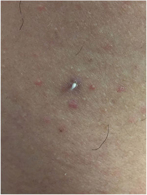 Clinical appearance of the lesion.