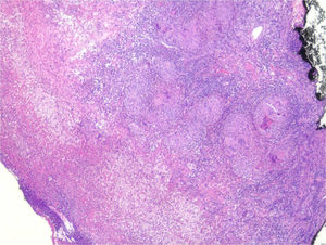 Hematoxilina-eosina (x100).