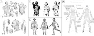 Líneas de Langer (A) (citado de «On the anatomy and physiology of the skin. I. The cleavability of the cutis»9), líneas de anti-tensión de Kraissl (B) (citado de Kraissl14), líneas principales de pliegue de Pinkus (C) (citado de Pinkus20) y líneas escisionales biodinámicas de tensión cutánea de Paul (D) (citado de Paul18).