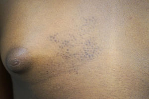 Clinical image of the patient