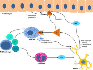 Schematic illustration of the local nerve inflammation cycle. NGF indicates nerve growth factor; NK-1R, neurokinin-1 receptor; SP, substance P.