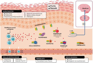 Ilustración esquemática del papel de la IL-31 en la piel. IL-31 es producida principalmente por las células Th2. Su receptor es un heterodímero de la IL-31RA y OSMRB expresado en múltiples células, incluyendo células inmunológicas, queratinocitos y neuronas periféricas. El ciclo del rascado-picor-inflamación-alteración epitelial (RPIA) ocurre durante la inflamación de la piel atópica.