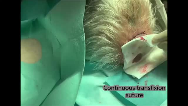 https://ars.els-cdn.com/content/image/1-s2.0-S000173102200518X-mmc1.mp4