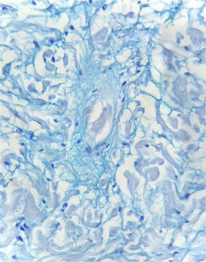 Alcian blue staining of mucin (×400).
