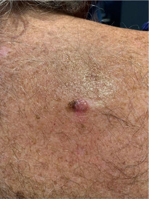 Clinical image.