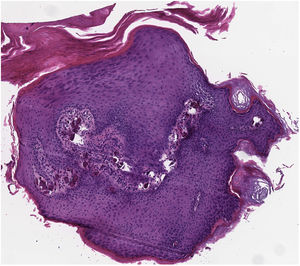 Hematoxilina-eosina, ×4.