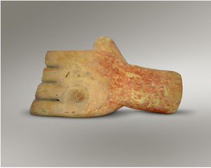 Clay model of a left hand bearing a nodule. Dating: Late 5th–2nd half of 4th century BC, Asclepieion of Corinth. The votive depicts a nodule overlying the distal part of the fourth metacarpal of the left hand. The red paint that used to cover it may indicate that the lesion represented an injury/bite, an abscess, or even a cutaneous malignancy.