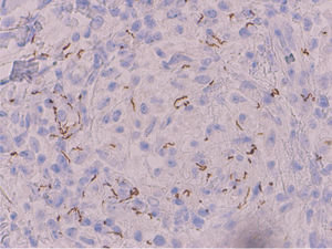 Tinción inmunohistoquímica. Anticuerpos antitreponema, 400×.