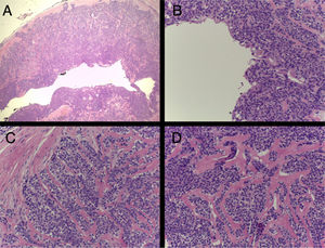 A: hematoxilina-eosina 20x, B-C-D: hematoxilina-eosina 200x.