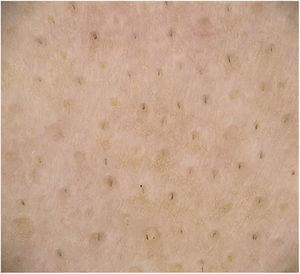 Black dots.