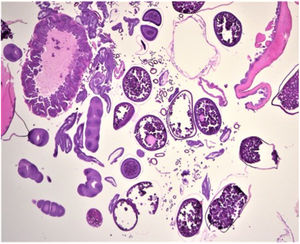 Hematoxylin–eosin, original magnification ×40.