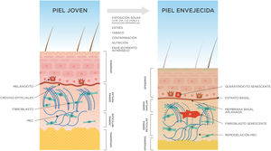 Cambios cutáneos secundarios al envejecimiento intrínseco y extrínseco (exposoma). La piel envejecida presenta una epidermis atrófica, con queratinocitos y melanocitos senescentes, y una membrana basal aplanada. La dermis papilar se reduce significativamente, hay fibroblastos senescentes y una remodelación significativa de la matriz extracelular. El tejido subcutáneo también disminuye su grosor. MEC: matriz extracelular.
