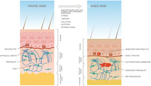 Skin changes induced by intrinsic and extrinsic aging (exposome). Aged skin is characterized by an atrophic epidermis, with senescent keratinocytes and melanocytes and a flattened basement membrane. Other features include a significantly reduced papillary dermis, senescent fibroblasts, significant extracellular matrix (ECM) remodeling, and subcutaneous tissue thinning.