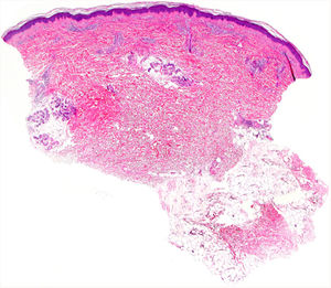 Panoramic histological image.