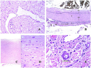 (A) Lymphatic vessel. The endothelium lies directly on the basement membrane. Two valves are easily seen in the vessel (hematoxylin–eosin ×200). (B) Artery. This histochemical stain for elastic tissue shows the three layers of a normal artery: the intimal (I), medial (M), and adventitial (A). Two thick elastic bands divide these three layers: the internal elastic lamella (IEL) and the external elastic lamella (EEL) (Van Gieson elastic staining ×20). (C) Aorta. The medial layer is rich in elastic fibers (hematoxylin–eosin ×20). Such feature is better appreciated at a high magnification (hematoxylin–eosin ×200). (D) Arteriole (hematoxylin–eosin ×400).