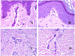 (A) Capillary blood vessel. These vessels have a narrow diameter and their wall is made of endothelial cells plus the basement membrane (hematoxylin–eosin ×400). (B) Capillary. The wall is composed only of endothelia positioned directly on the basement membrane (hematoxylin–eosin ×400). (C) Pericytes (arrow) are sometimes clearly evidenced in some capillaries with the hematoxylin–eosin stain (hematoxylin–eosin ×400). (D) Venule. A thin layer of connective tissue is seen underneath the basement membrane (hematoxylin–eosin ×200).