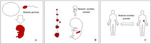 Esquema de mutaciones prenatales y posnatales, y desarrollo de las malformaciones vasculares y los tumores. Las mutaciones prenatales pueden ser germinales (A) o somáticas (B). En el primer caso, todas las células del individuo portarán la mutación. En las mutaciones prenatales somáticas, por el contrario, solo las células desarrolladas después de la mutación portarán el defecto genético. Es por ello por lo que comúnmente se distribuyen de forma lineal o segmentaria, muchas veces siguiendo las líneas de Blaschko (B). Las mutaciones somáticas posnatales (C) producen principalmente tumores, que no suelen mostrar una distribución lineal.