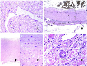 A) Vaso linfático. El endotelio se encuentra directamente sobre la membrana basal. Se ven fácilmente dos válvulas en el vaso (hematoxilina-eosina ×200). B) Arteria. Esta tinción histoquímica para tejido elástico muestra las 3 capas de una arteria normal: la íntima (I), la media (M) y la adventicia (A). Dos bandas elásticas gruesas dividen estas 3 capas: la lámina elástica interna (LEI) y la lámina elástica externa (LEE) (tinción elástica de Van Gieson ×20). C) Aorta. La capa media es rica en fibras elásticas (hematoxilina-eosina ×20). Tal característica se aprecia mejor a gran aumento (hematoxilina-eosina ×200). D) Arteriola (hematoxilina-eosina ×400).
