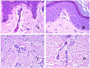 A) Vaso sanguíneo capilar. Estos vasos tienen un diámetro estrecho y su pared está formada por células endoteliales más la membrana basal (hematoxilina-eosina ×400). B) Capilar. La pared se compone únicamente de endotelio colocado directamente sobre la membrana basal (hematoxilina-eosina ×400). C) Los pericitos (flecha) a veces se evidencian claramente en algunos capilares con la tinción de hematoxilina-eosina (hematoxilina-eosina ×400). D) Vénula. Se observa una fina capa de tejido conjuntivo debajo de la membrana basal (hematoxilina-eosina ×200).