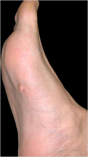 Figura 1