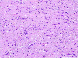 Hematoxilina-eosina, ×200.