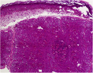 Henderson–Patterson bodies, characteristic of molluscum contagiosum virus.