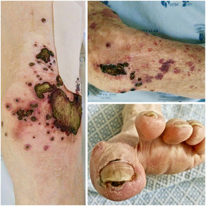 Clinical picture.