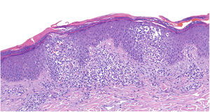 Hematoxilina-eosina 4X.