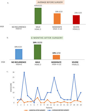 Reduction of disease severity after surgery. Graph shows percentage of patients with different degrees of disease severity according to the International Hidradenitis Suppurativa Severity Score System (IHS4). (a) Six months prior to surgery (average). (b) At six-month of follow up. (c) Baseline IHS4 and after surgery (6 months).