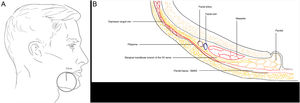 A, Zone 2: Marginal branch of the facial nerve (VII). B, Tissue planes in the zone. SMAS indicates superficial musculoaponeurotic system.