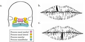 Estructuras que intervienen en la fusión de los planos embrionarios faciales (a). Por esta disposición, las fisuras labiales superiores tienden a la lateralidad (b), mientras que las inferiores suelen aparecer en la línea media (c).