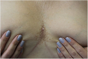 Figura 1