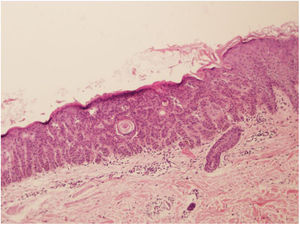 Figura 3