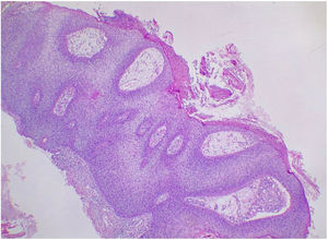 100×. Hematoxilina y eosina