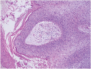 200×. hematoxilina y eosina