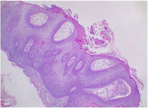 Hematoxylin–eosin (original magnification ×100).