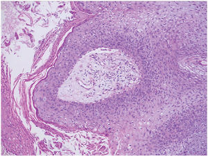 Hematoxylin–eosin (original magnification ×200).