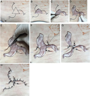 A-H: Descripción visual detallada de la técnica de reconstrucción sobre piel porcina.