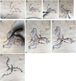 A-H: Detailed visual description of the reconstruction technique on porcine skin.