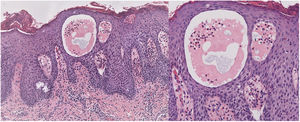 Tinción hematoxilina-eosina. Aumentos 10× y 20×.