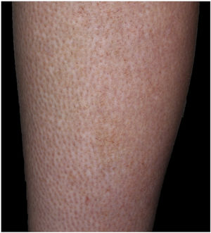 Clinical image.