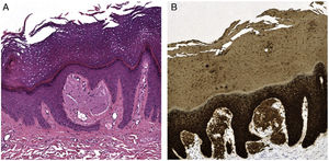 Histopathology.
