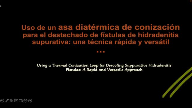 https://ars.els-cdn.com/content/image/1-s2.0-S0001731024001522-mmc1.mp4
