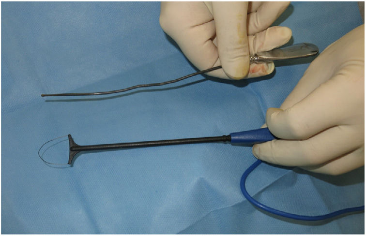 translated-article-use-of-loop-diathermy-conization-for-deroofing